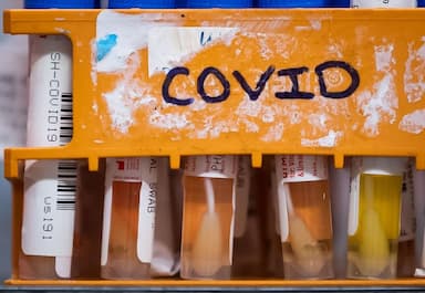 b-c-first-nation-faces-covid-19-outbreak-community-leaders-issue-racism-warnings