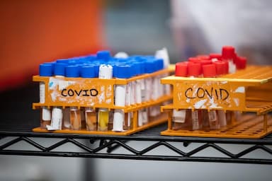 authorities-seized-380-shipments-of-covid-19-related-goods-along-the-bc-border-with-the-us