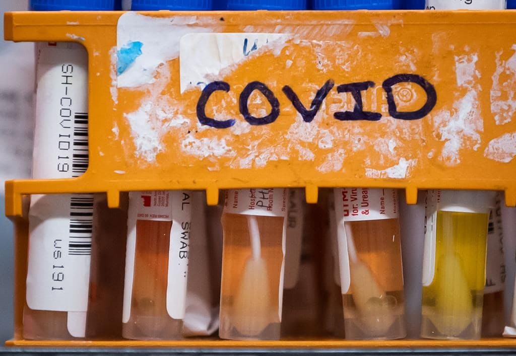 indigenous-leaders-are-encouraging-people-to-get-first-doses-of-covid-19-vaccines