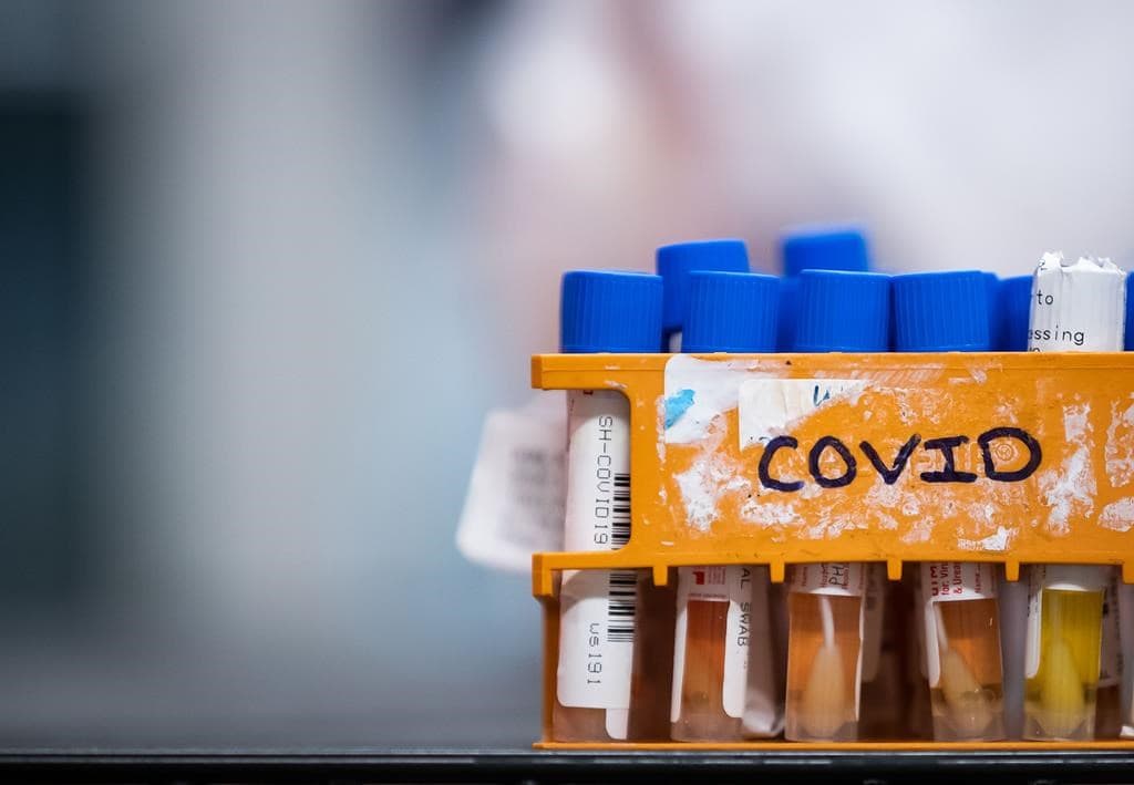 constant-rise-of-covid-19-cases-in-various-provinces-in-canada