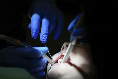 statistics-canada-people-not-visiting-dentist-due-to-high-cost-lack-of-insurance