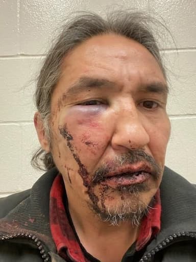 charges-against-first-nation-chief-allan-adam-dropped