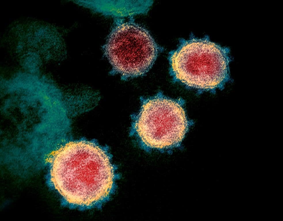 health-canada-approves-serological-test-to-detect-covid-19-antibodies