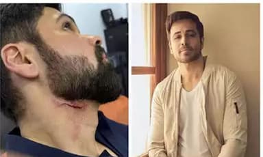 emraan-hashmi-injured