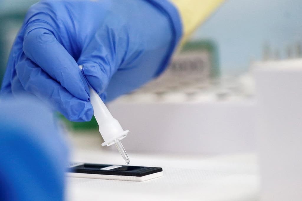 ottawa-publishes-guidance-for-rapid-covid-19-tests