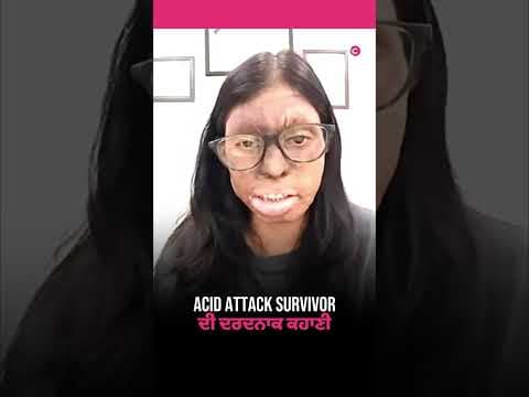 Acid Attack Survivor Reveals Shocking Childhood Trauma