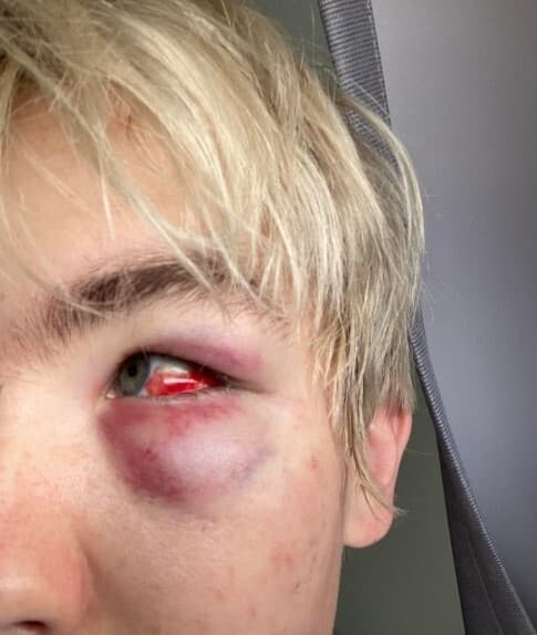 nanaimo-rcmp-investigate-assault-as-possible-hate-crime-one-man-arrested